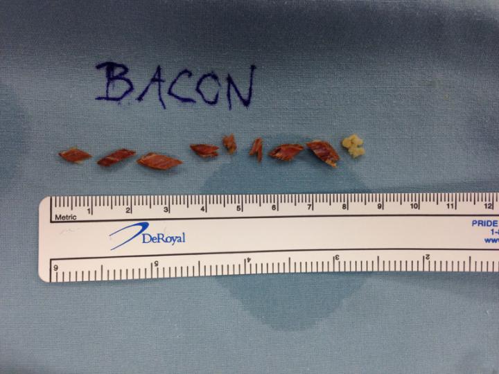 Bacon in Trachea