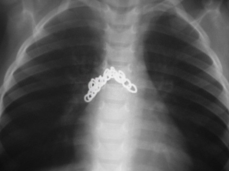 Radiographie d'une chaîne en métal (a.-p.)