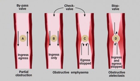 Radiographic Findings