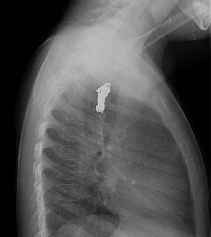 Radiographie d'une breloque en forme de patin (latéral)