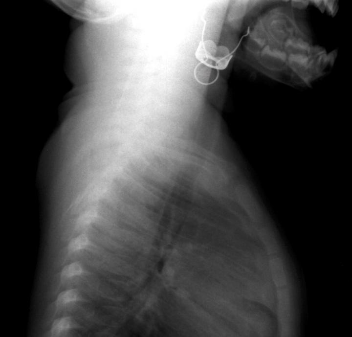 Radiografia enfeite (lateral)