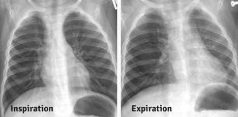 Xray Comparison